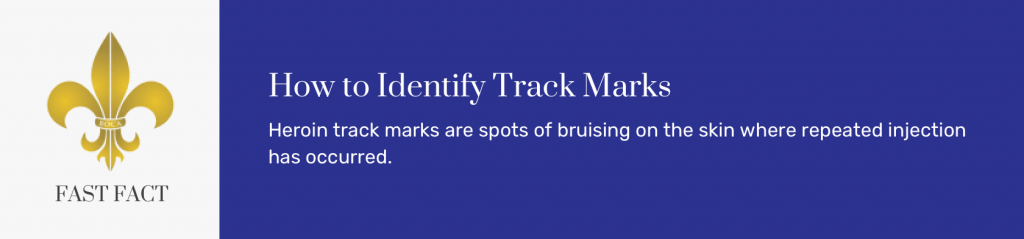 How to Identify Track Marks@2x