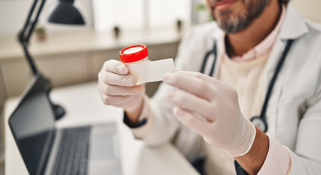 How Long Does Cocaine Stay in Urine? A Detailed Analysis - Boca